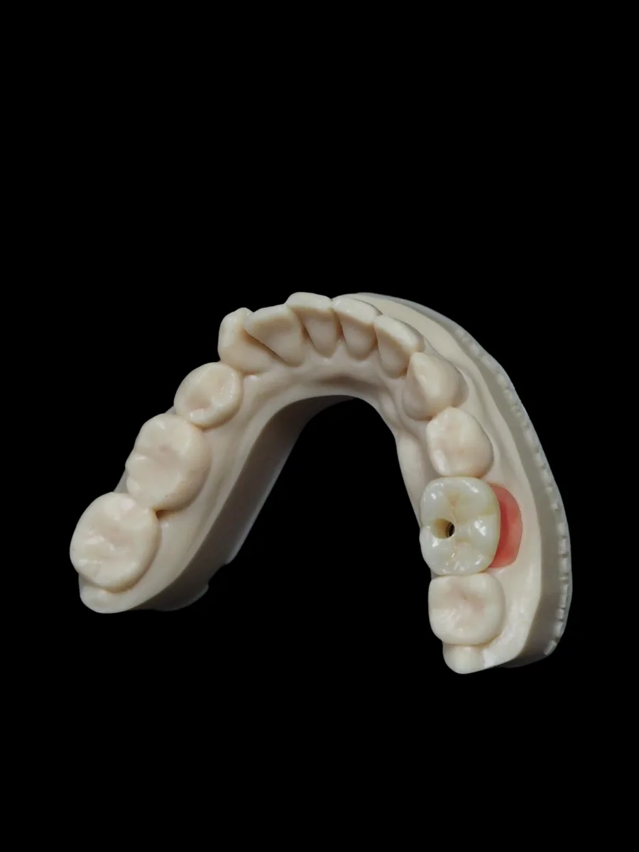 Guide chirurgical à étages